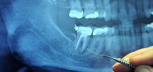 لطالما شكلت الأسنان جزءا مهما لدى الإنسان نظرا لدورها الوظيفي الهام للإنسان من خ صورة: لطالما شكلت الأسنان جزءا مهما لدى الإنسان نظرا لدورها الوظيفي الهام للإنسان من خ