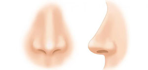 فيديو عن الناميات الأنفية صورة: فيديو عن الناميات الأنفية