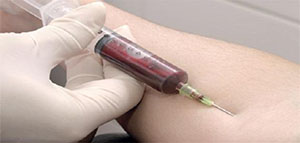 تحليل MCHC و خلايا الدم الحمراء و الهيموجلوبين صورة: تحليل MCHC و خلايا الدم الحمراء و الهيموجلوبين