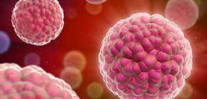 صورة: سرطان البروستاتا عند الرجال في الأردن و تشخيص سرطان البروستاتا عند الرجال