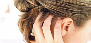 صورة: حكة الرأس و أسباب حكة الرأس و علاجات منزلية لحكة الرأس