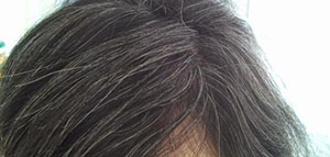 صورة: شيب الشعر و أسباب ظهور الشيب و طرق التخلص من الشيب