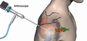 صورة: ما هي الجراحه النسائية بالمنظار و ما هي فوائد و ايجابيات جراحة المنظار على