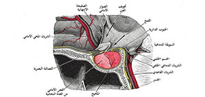 صورة: أورام الغدة النخامية و أسباب أورام الغدة النخامية