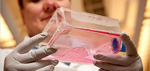 الحبوب و أسباب ظهور حبوب حمراء على الرقبة صورة: الحبوب و أسباب ظهور حبوب حمراء على الرقبة