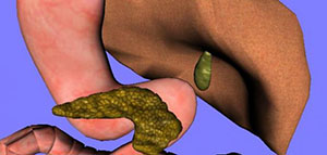 صورة: التهاب المرارة و أنواع التهاب المرارة