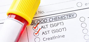 صورة: إنزيمات الكبد التي تساعد على عملية الأيض الخاصة بالبروتين