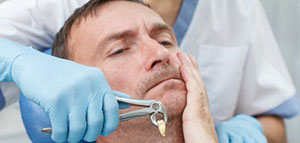 صورة: طرق خلع السن و خطوات خلع الأسنان و أسباب خلع الأسنان