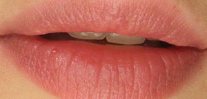 صورة: العناية بالشفاه و طرق لجعل الشفاه وردية