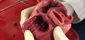 صورة: الشرايين