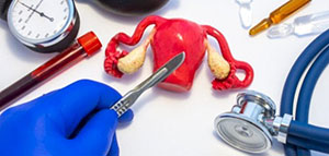 صورة: ماذا يحدث بعد استئصال الرحم و التعافي من عملية استئصال الرحم