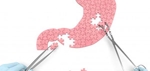 صورة: علاج قرحة المعدة و المتابعة الأولية بعد العلاج