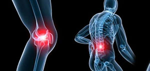 صورة: آلام المفاصل و ما هي أعراض آلام المفاصل