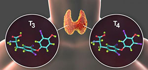 صورة: نشاط الغدة الدرقية و أسباب نشاط الغدة الدرقية