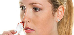 صورة: أسباب نزيف الأنف المفاجئ و الأشخاص الأكثر عرضة لنزيف الأنف[d]23