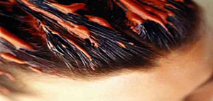 صورة: بلسم الشعر و كيفية عمل بلسم الشعر و وصفة طبيعية لصناعة البلسم