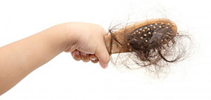 صورة: قصور الغدة الدرقية و داء الثعلبة و تساقط الشعر الكربي