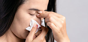 صورة: النزيف و كيفية إيقاف النزيف و كيفية إيقاف نزيف الأنف