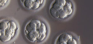 صورة: نصائح بعد ترجيع الأجنة و دواعي مراجعة الطبيب