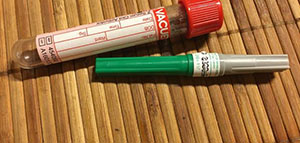 تحليل البرولاكتين و أسباب إجراء تحليل البرولاكتين صورة: تحليل البرولاكتين و أسباب إجراء تحليل البرولاكتين