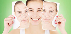 صورة: الطرق الطبية