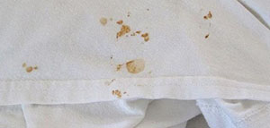 صورة: بقع الصدأ على الملابس و كيفية إزالة بقع الصدأ عن الملابس