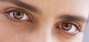 صورة: الهالات السوداء تحت العين و أسباب ظهور الهالات السوداء تحت العين