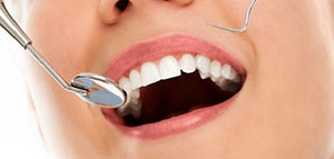 صورة: أسباب التهاب اللثة و نصائح للوقاية من التهاب اللثة