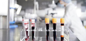 صورة: ما هو هرمون TSH و كيفية التحكم في مستويات هرمون TSH