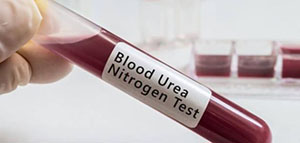 صورة: ارتفاع اليوريا و أسباب ارتفاع نيتروجين اليوريا